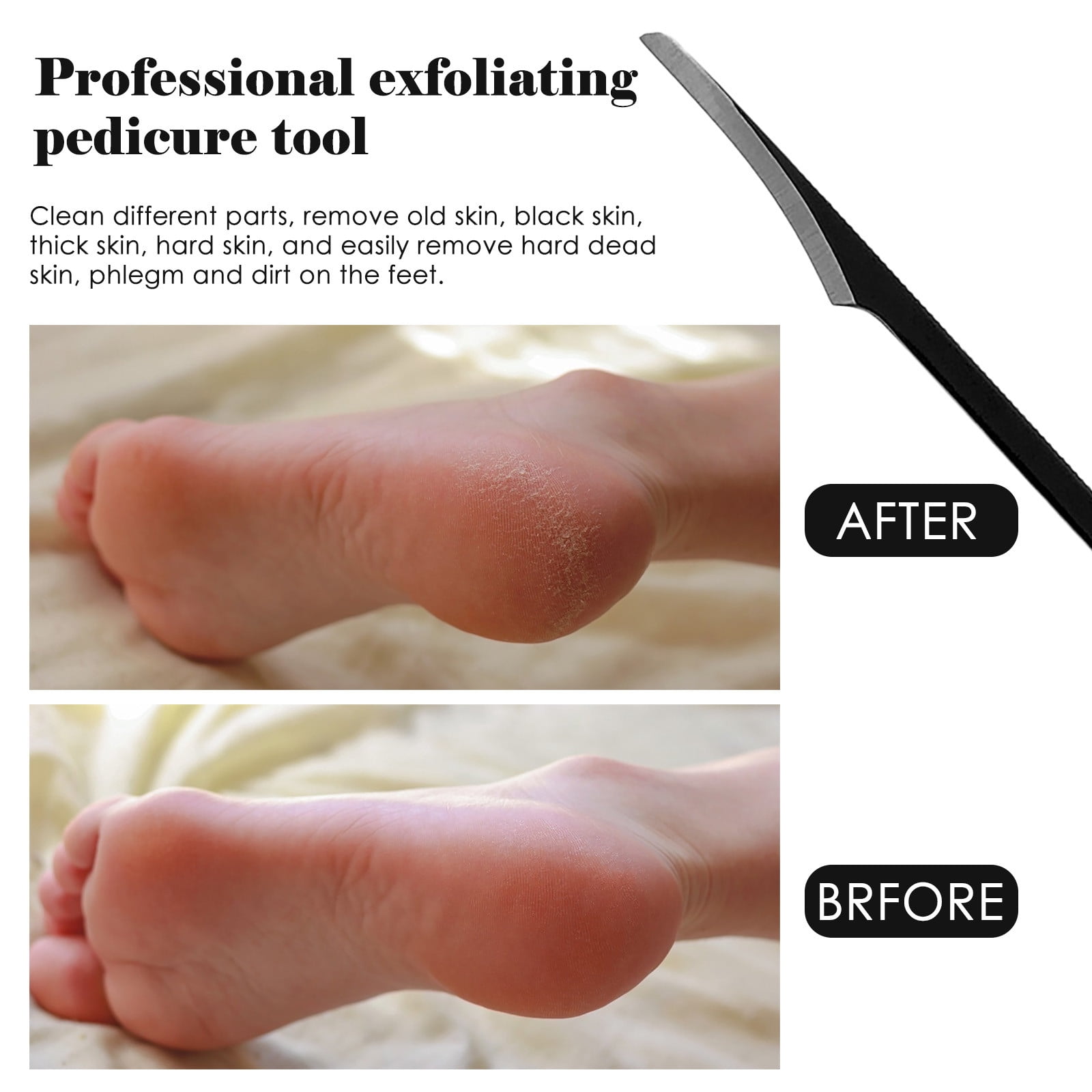 Wozhilaka Professional Stainless Steel Foot Pedicure Knife (Black, 6.5 in) a03a2