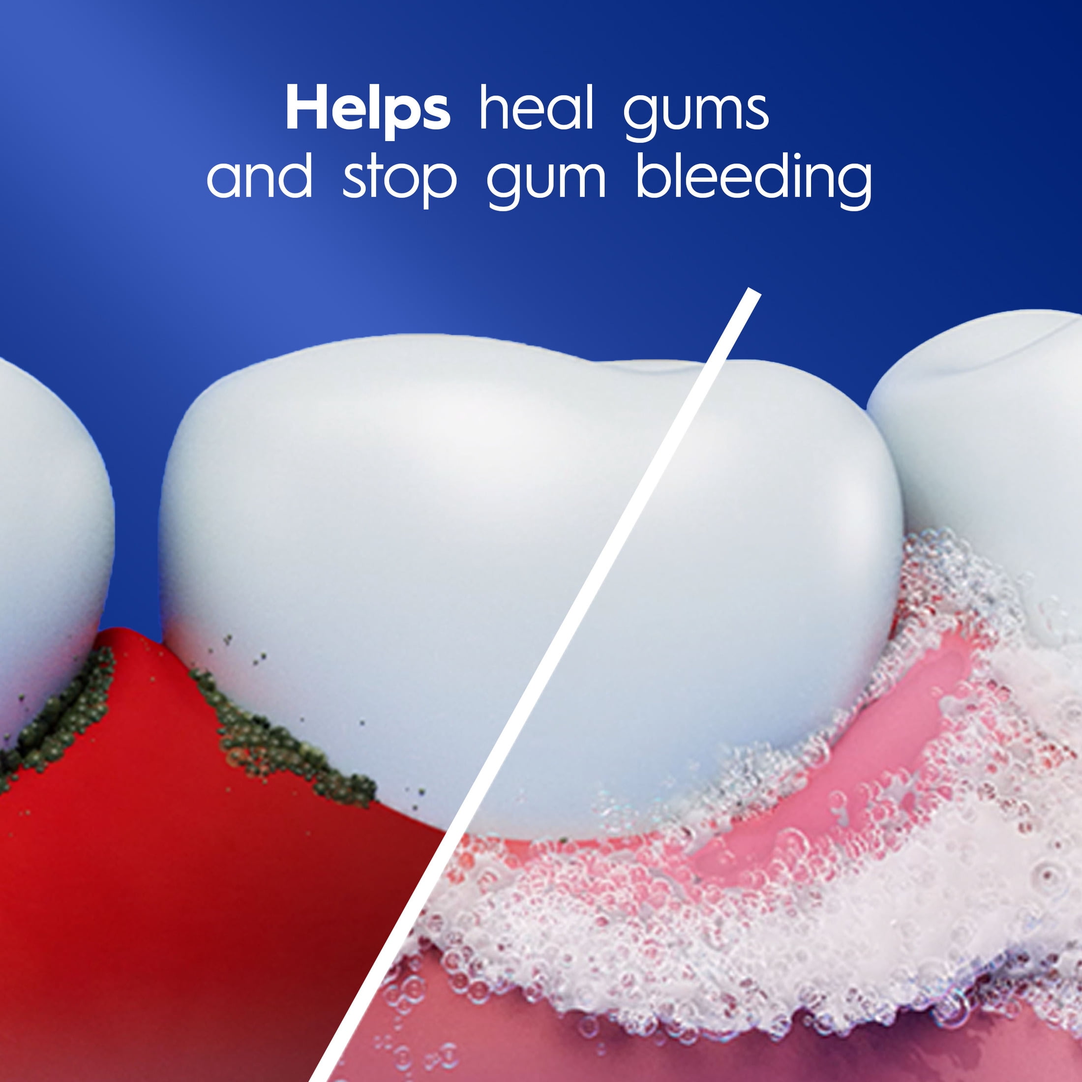 Crest Pro-Health Gum Detoxify Deep Clean Toothpaste (White, 4.8 oz, 3 Pack) bqd5b