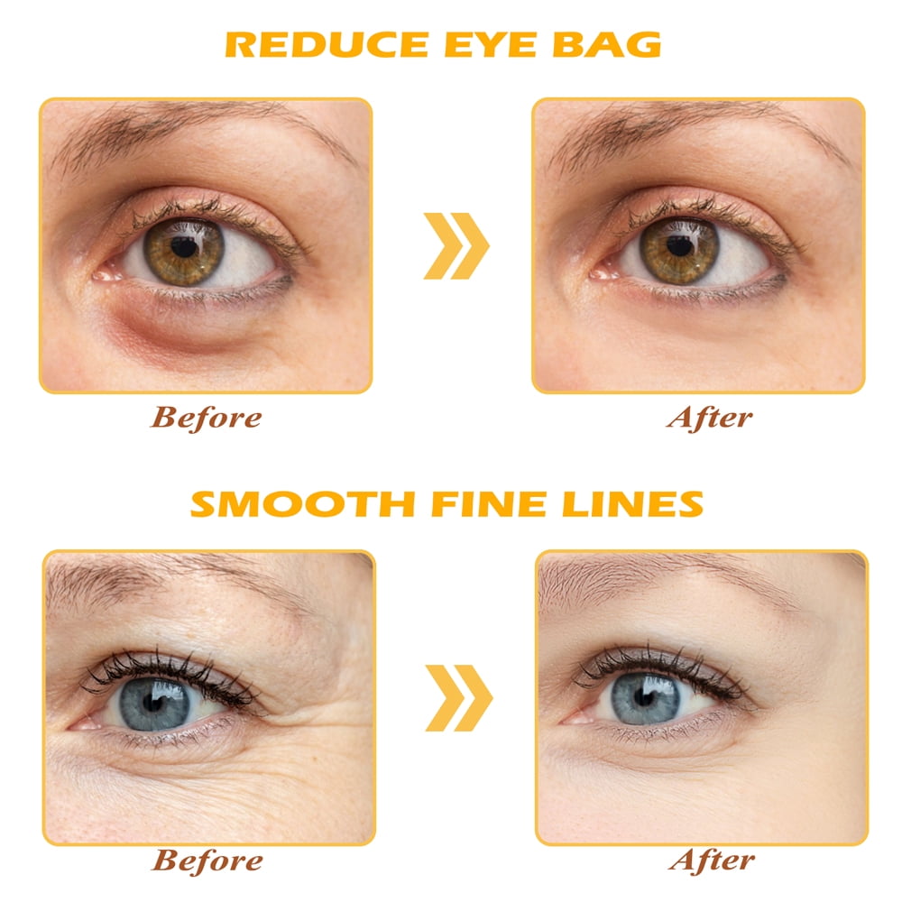 Devimic Golden Collagen Under Eye Masks for Dark Circles and Puffiness (Gold, 30 Pairs) o60cd