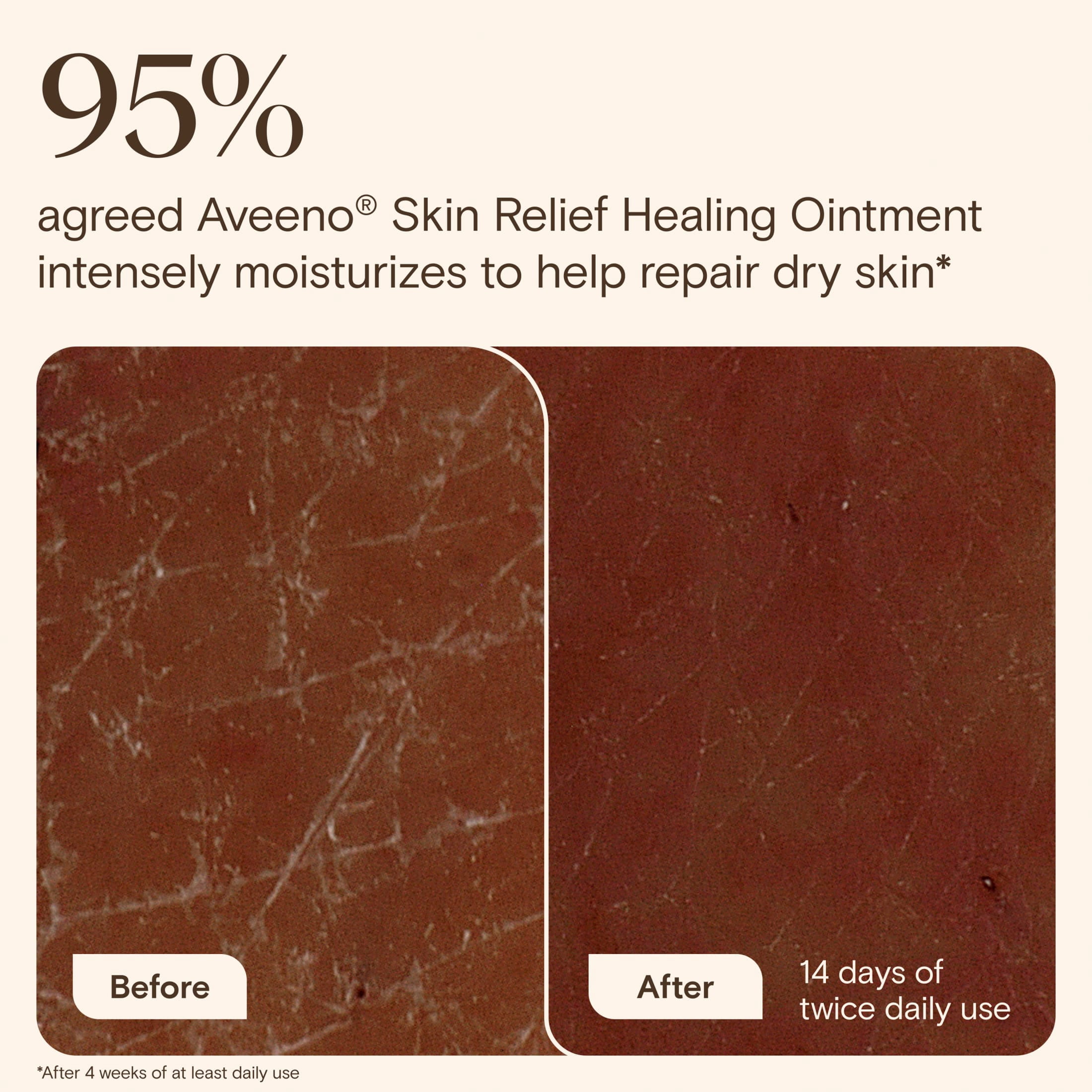 Aveeno Skin Relief Healing Ointment for Dry Cracked Skin (Fragrance-Free, 7.2 oz) 4myou