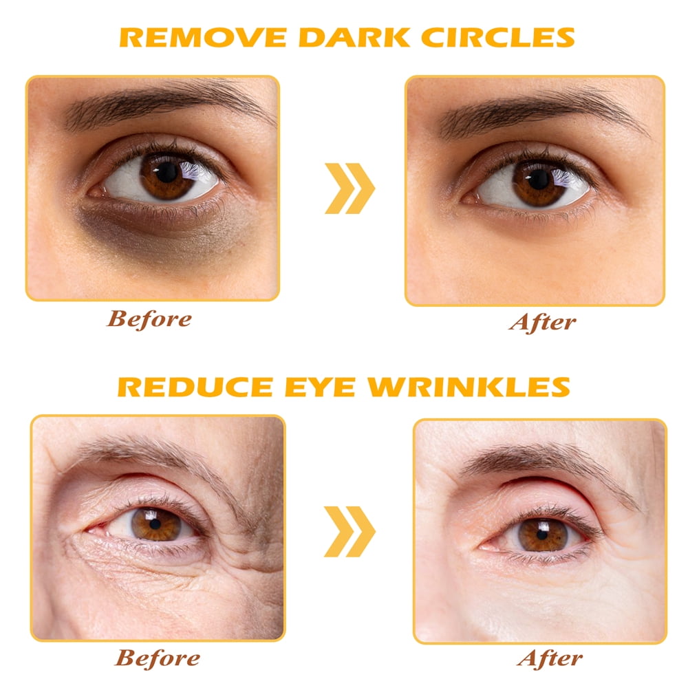 Devimic Golden Collagen Under Eye Masks for Dark Circles and Puffiness (Gold, 30 Pairs) o60cd
