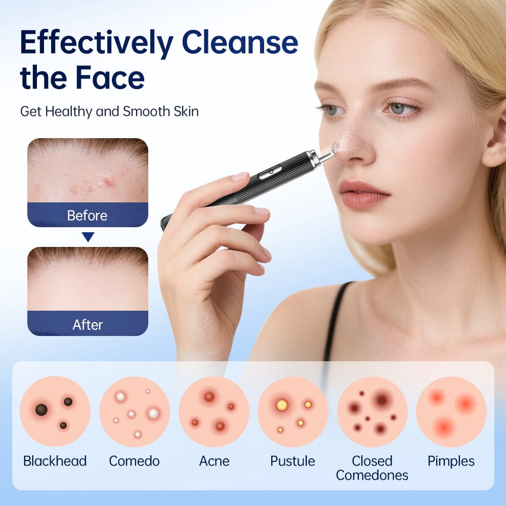 BearCris Visual Blackhead Remover with 1296P HD Camera and 50X Magnification (White, 1 Piece) s043j