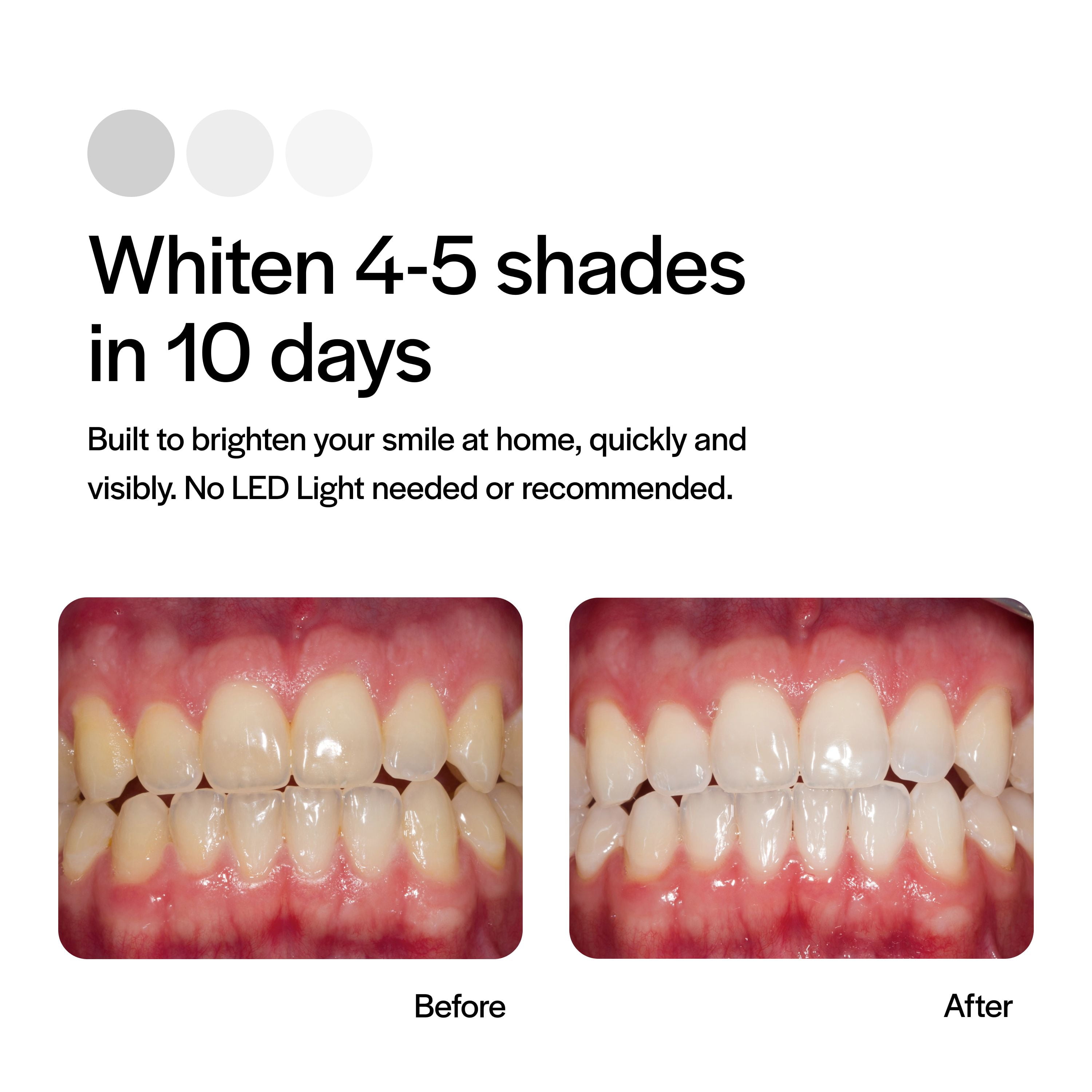 Opalescence Go 15% Hydrogen Peroxide Teeth Whitening Trays (Cool Mint, 7 Treatments) oui4d