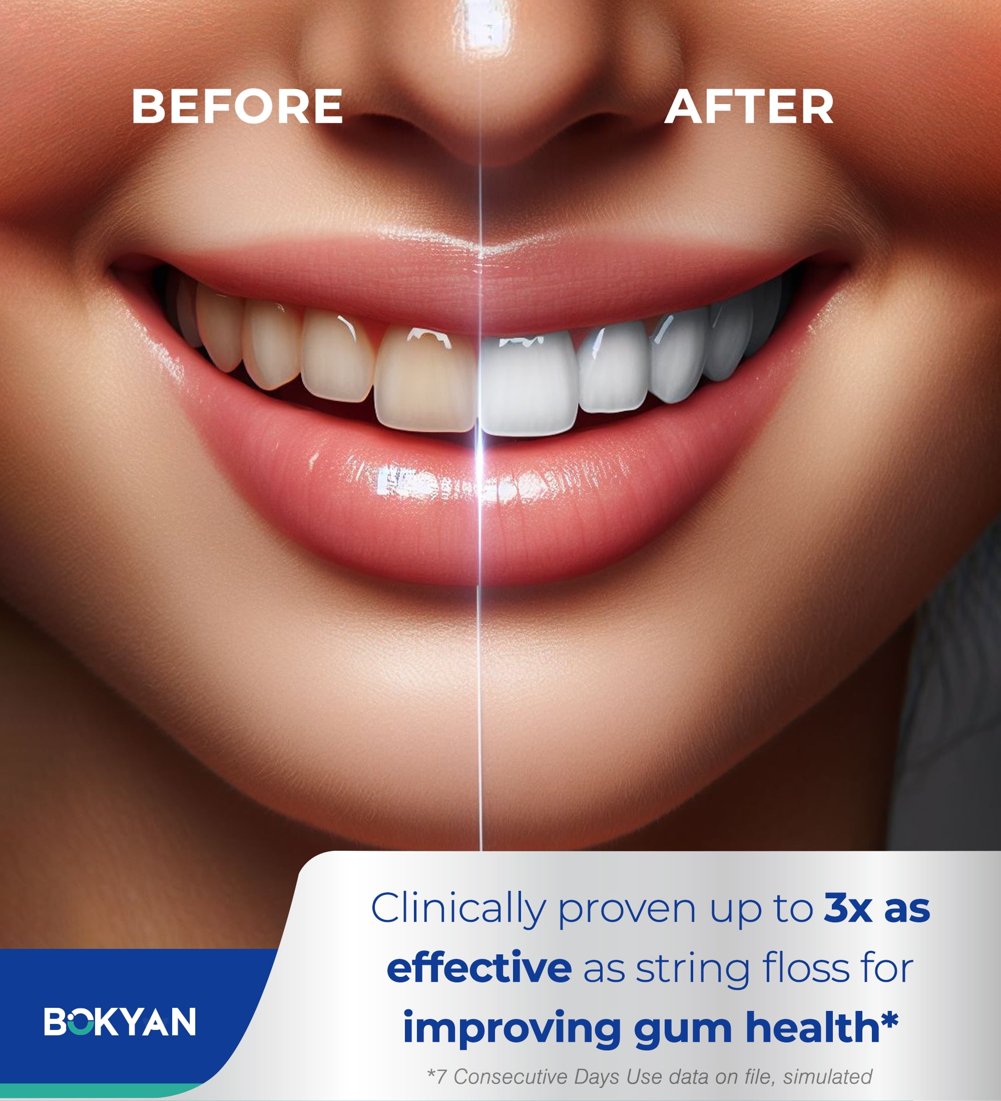 BOKYAN Cordless Water Flosser for Teeth, Portable Electric Dental Oral Irrigator with 3 Modes (White, 6.76 fl oz) qyg43