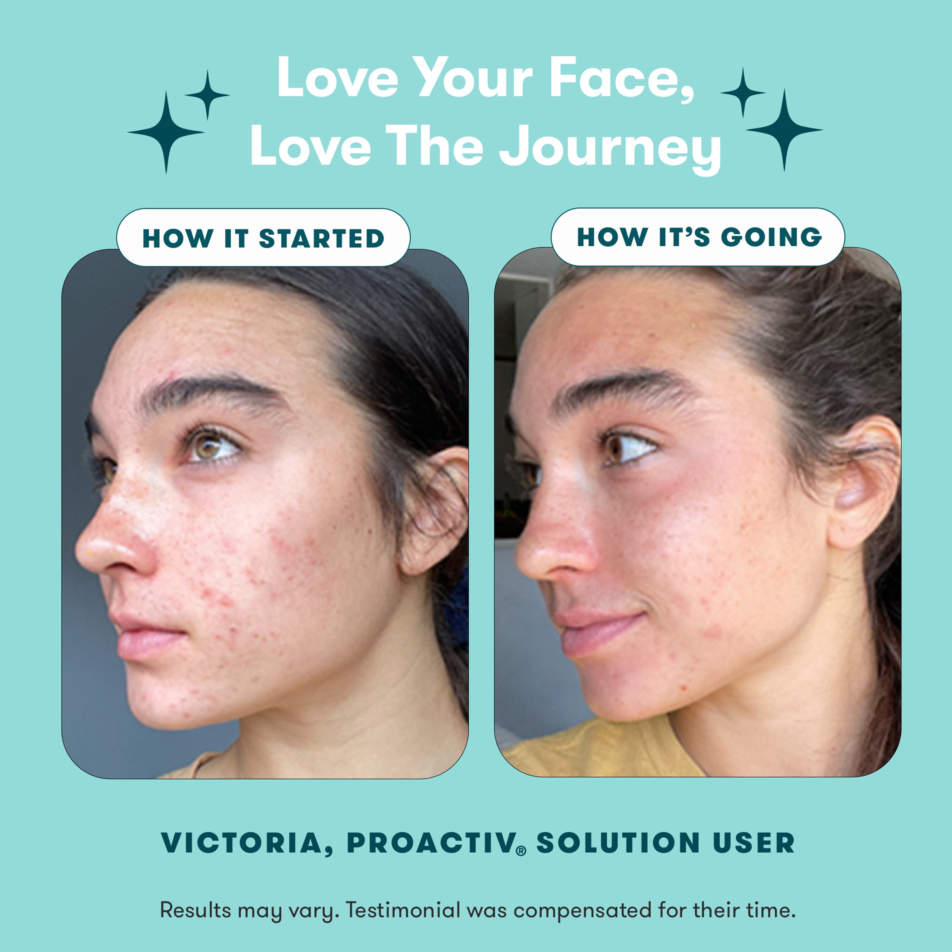 Proactiv Solution 3-Step Acne Treatment System (30-Day Supply) fz4q3