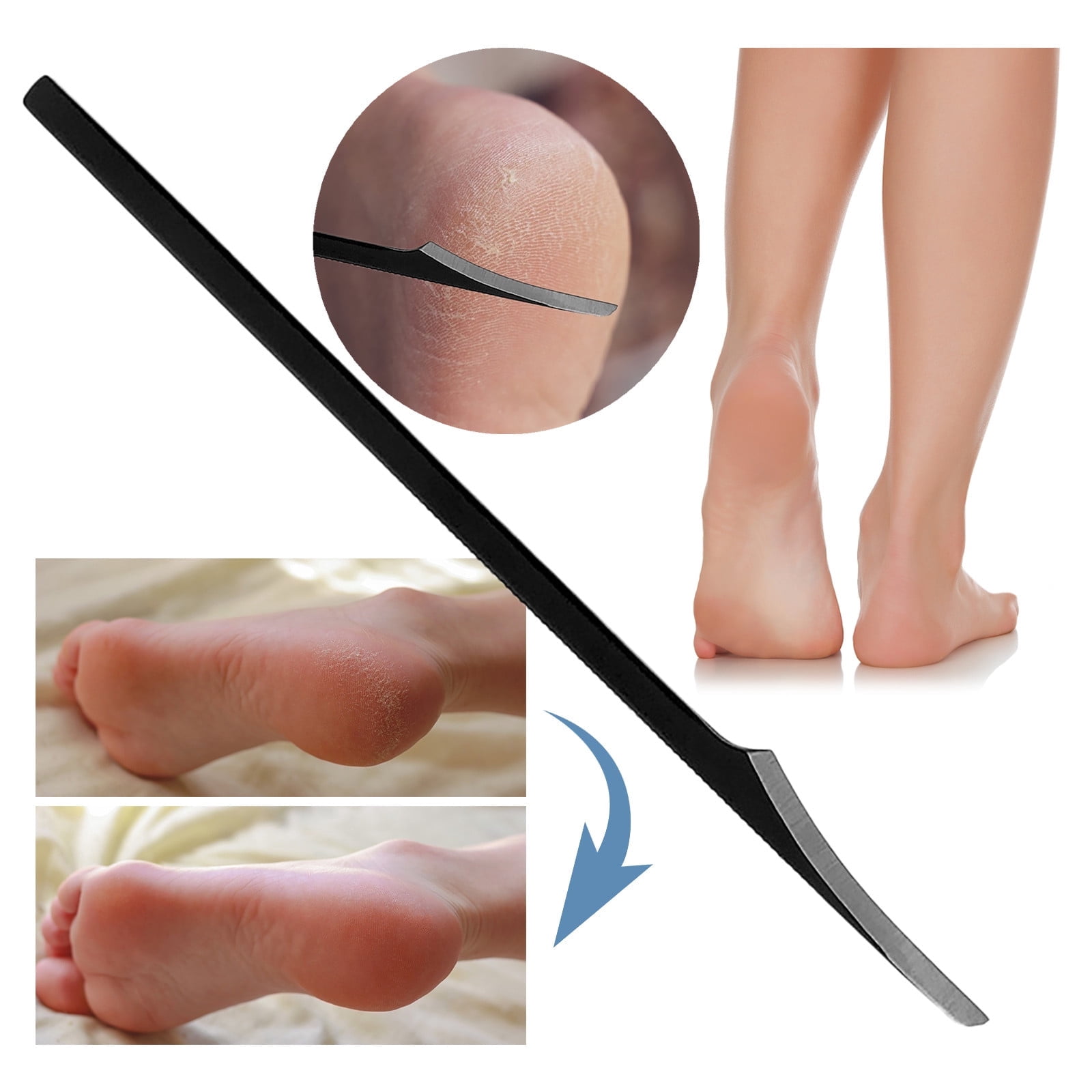 Wozhilaka Professional Stainless Steel Foot Pedicure Knife (Black, 6.5 in) a03a2