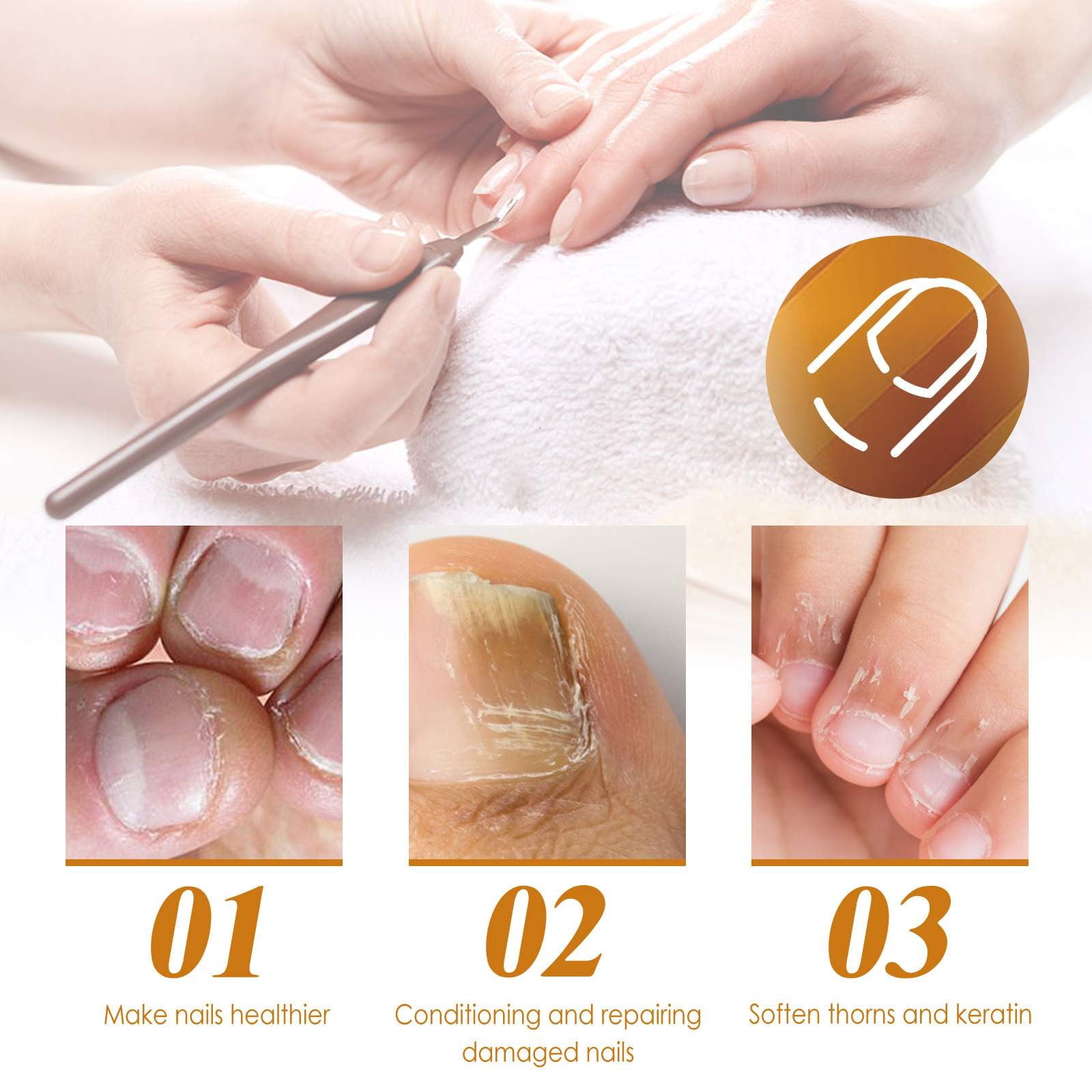 Beessbest Instant Cuticle Remover Gel, Professional Manicure & Pedicure Nail Care Treatment (1 fl oz) 1qclh