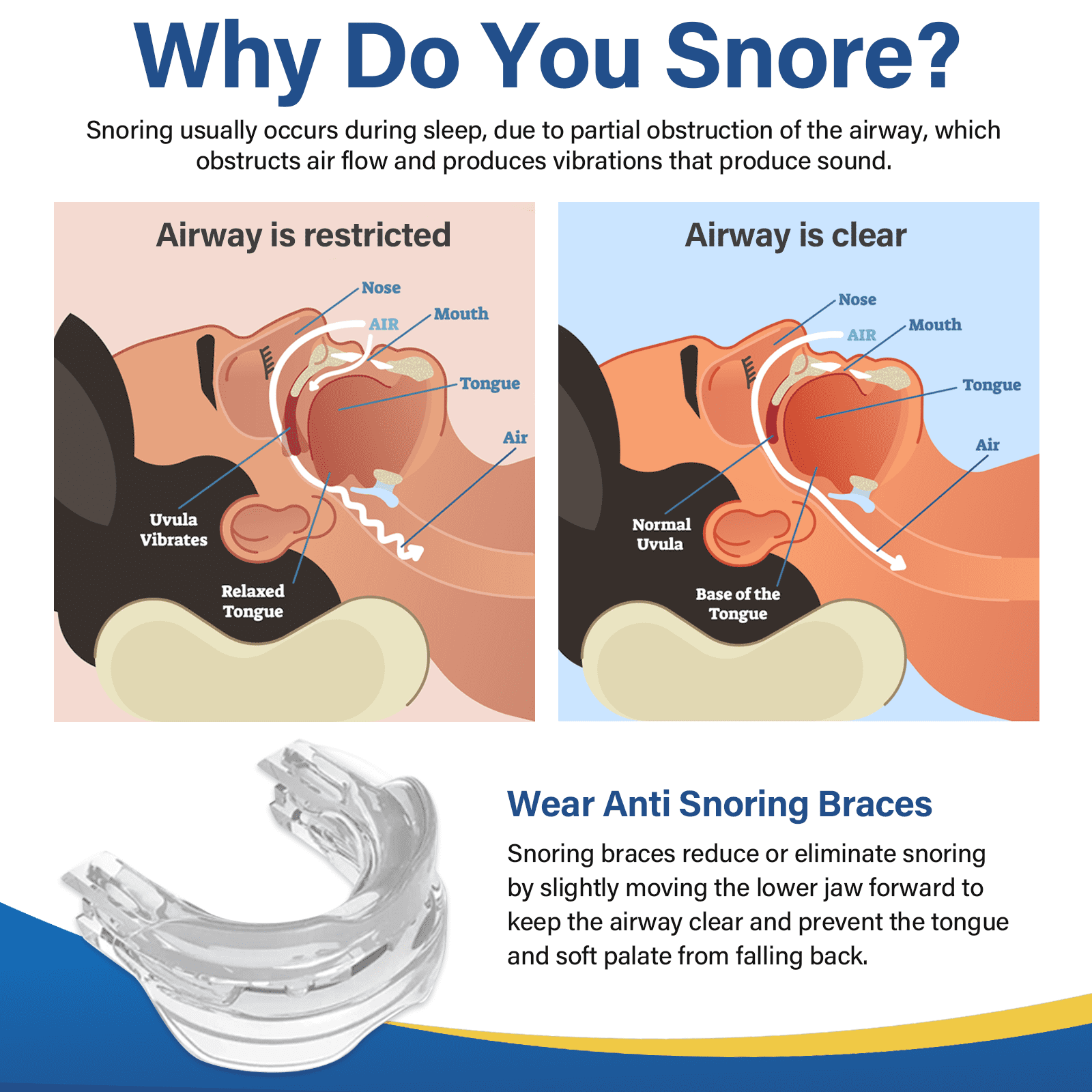 CiYouc Anti-Snore Mouthpiece, Adjustable Sleep Aid Mouth Guard for Snoring Relief (White, One Size) upx2x