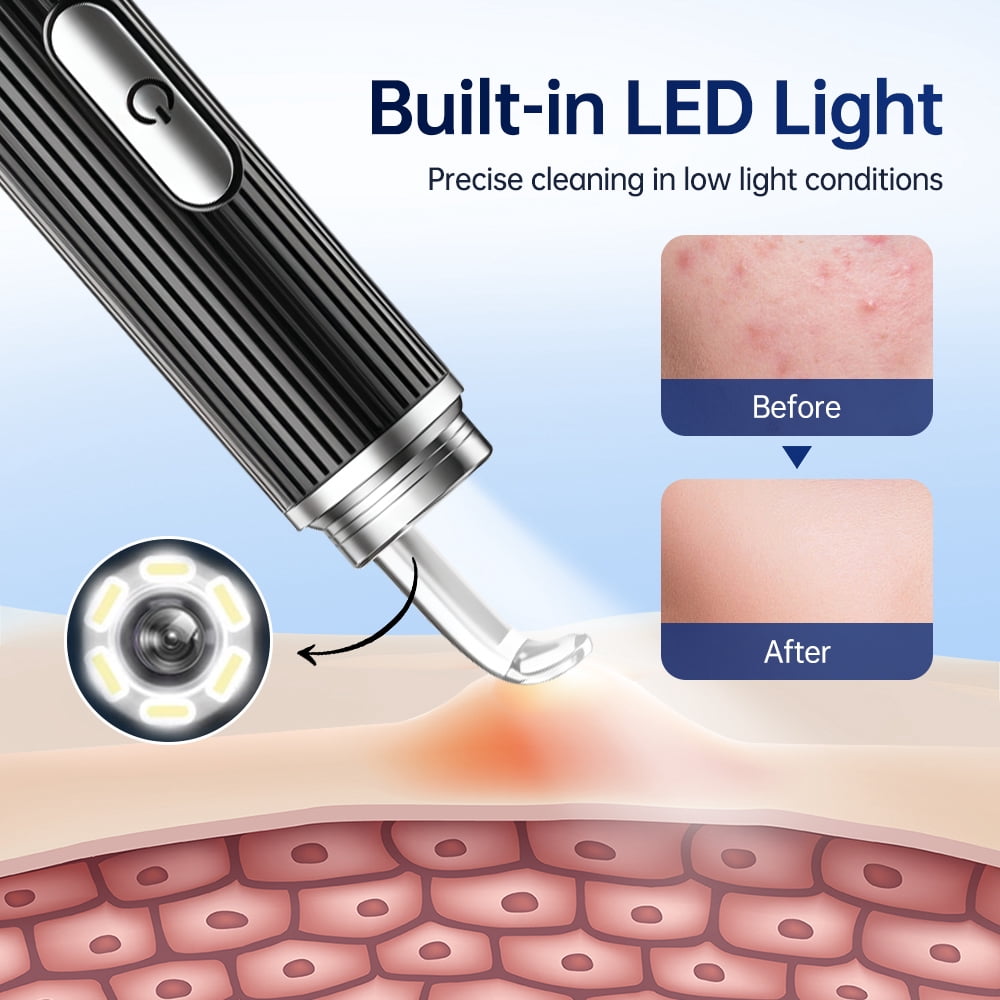 BearCris Visual Blackhead Remover with 1296P HD Camera and 50X Magnification (White, 1 Piece) s043j